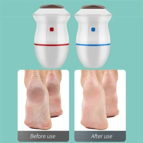 Electric Foot Grinder & Callus Remover | Rechargeable Pedicure - Image 2